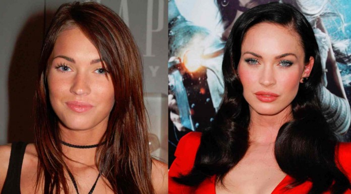 Famosas antes y después de la cirugía