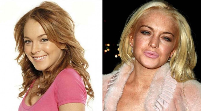 Algunas operaciones de las famosas no terminan quedando demasiado bien… ¡Alucina con Ashley y Mary Kate Olsen!