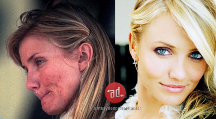 Los famosos también tiene granos ¡Mira estos increíbles cambios cuando no tienen maquillaje! LOL