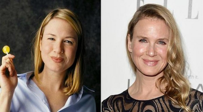 Celebridades antes y después de la cirugía ¡FAIL!