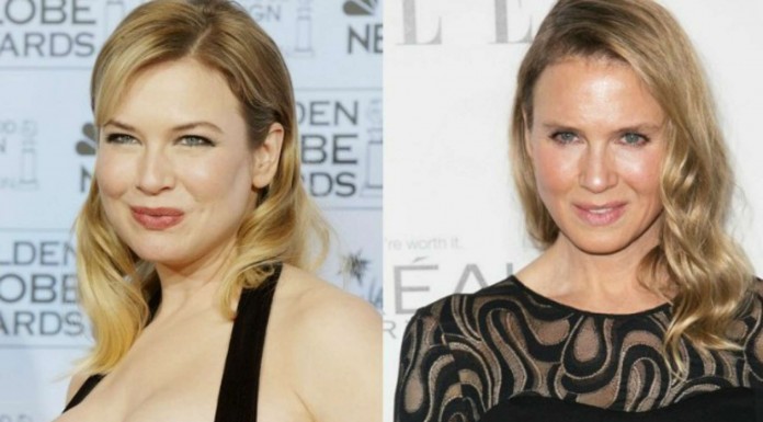 Celebrities que no podrán negar ¡su paso por el quirófano! (Parte I)